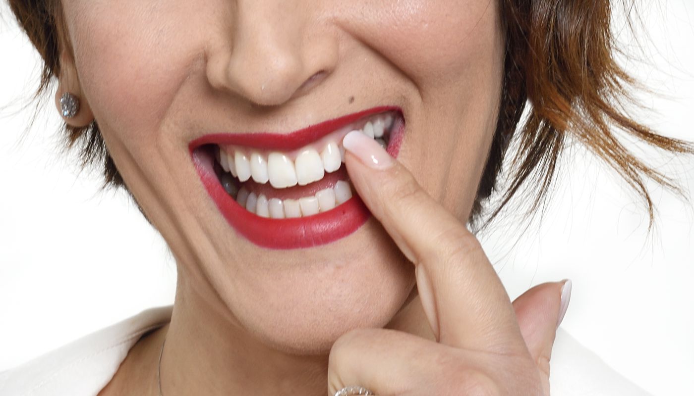 implantologia dentale